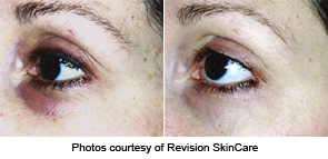 teamine eye complex reviews